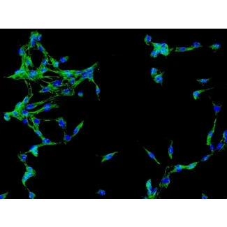 Human Brain Vascular Adventitial Fibroblasts (HBVAF) - Immunostaining for Fibronectin, 200x.
