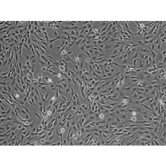 Human Brain Vascular Pericytes (HBVP) - Phase contrast, 100x.
