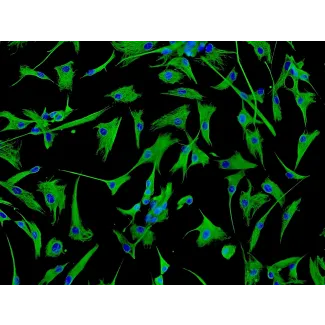 Human Cardiac Fibroblasts-atrial (HCF-aa) - Immunostaining for Vimentin, 200x.