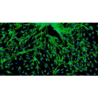 Human Cardiac Fibroblasts-fetal atrial (HCF-fa) - Immunostaining for Fibronectin, 100x.
