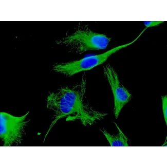 Human Cardiac Fibroblasts (HCF) - Immunostaining for Vimentin, 600x..