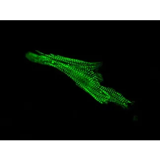 Human Cardiac Myocytes (HCM) – Immunostaining for Sarcomeric alpha-Actinin (Boster, Cat #MA1104)
 
