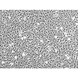 Human Chondrocytes-articular (HC-a) - Phase contrast, 100x.

