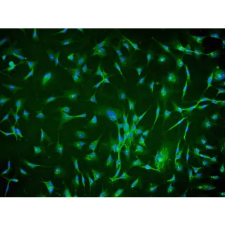 Human Chorionic Mesenchymal Stromal Cells (HCMSC) - Immunostaining for CD105, 200x.

