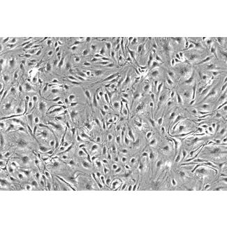 Human Choroid Plexus Endothelial Cells (HCPEC) - Phase contrast, 200x.
