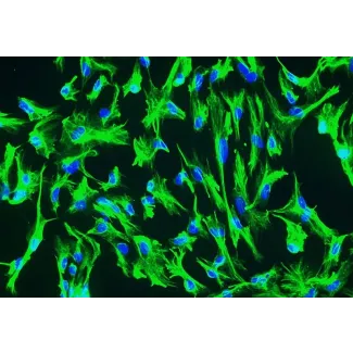 Human Choroid Plexus Epithelial Cells (HCPEpiC) - Immunostaining for CK-18, 200x.
