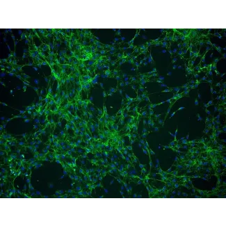 Human Choroid Plexus Fibroblasts (HCPF) - Immunostaining for Fibronectin, 100x.
