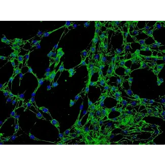 Human Conjunctival Fibroblasts (HConF) - Immunostaining for Fibronectin, 200x.
