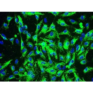 Human Coronary Artery Endothelial Cells (HCAEC) - Immunostaining for vWF, 200x.