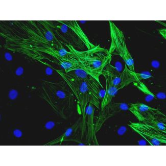 Human Coronary Artery Smooth Muscle Cells (HCASMC)-Immunostaining for α-SMA, 400x