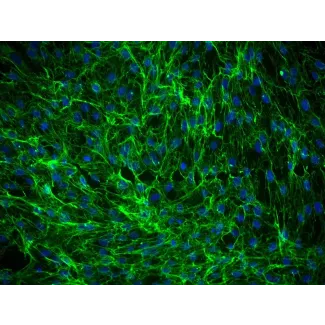 Human Dermal Fibroblasts-fetal (HDF-f) - Immunostaining for Fibronectin, 200x.
