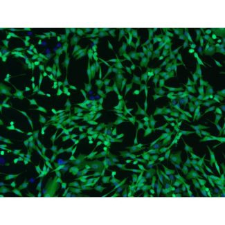 Human Dermal Fibroblasts-GFP (2310-GFP) – GFP fluorescence and Hoechst 100x
