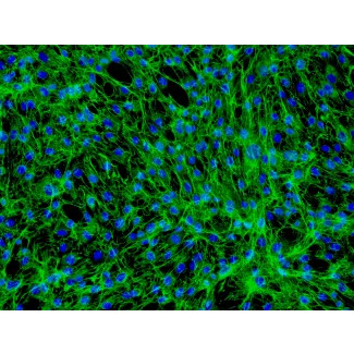 Human Dermal Fibroblasts-neonate (HDF-n) - Immunostaining for Fibronectin, 200x.
