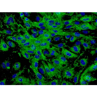 Human Dermal Microvascular Endothelial Cells (HDMEC) - Immunostaining for vWF, 400x.
