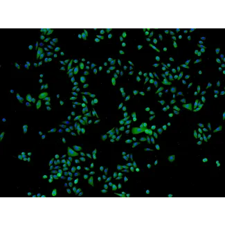 Human Epidermal Keratinocytes-fetal (HEK-f) - Immunostaining for CK-18, 100x.
