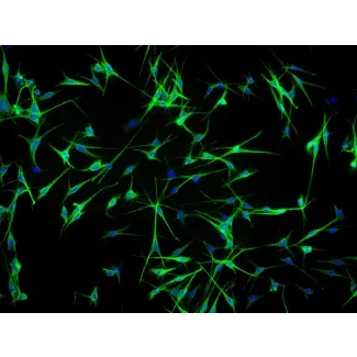 Human Epidermal Melanocyte-adult (HEM-a) - Immunostaining for S100-β, 100x.
