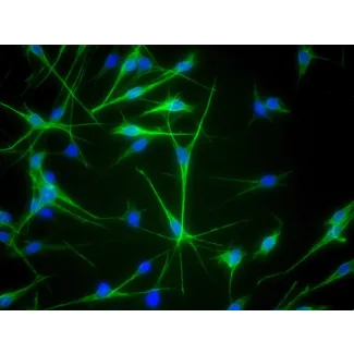 Human Epidermal Melanocytes-medium (HEM-m) - Immunostaining for S100-β, 400x.
