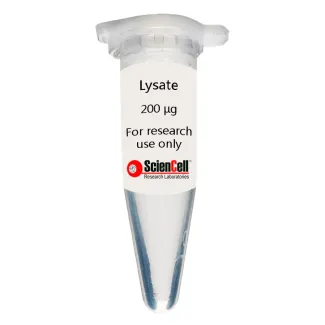 Human Esophageal Fibroblast Lysate