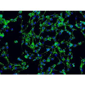 2730 Immunostaining FN 200x

