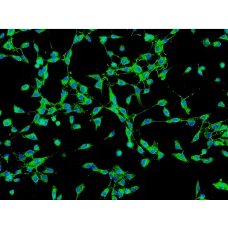 Human Gallbladder Fibroblasts (HGBF) - Immunostaining for Fibronectin, 200x.
