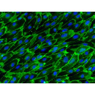 Human Gallbladder Vascular Endothelial Cells (HGBVEC)-Immunostaining for CD31, 400x