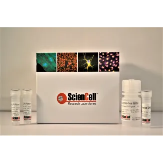 Human Global DNA Methylation Quantification qPCR Assay Kit