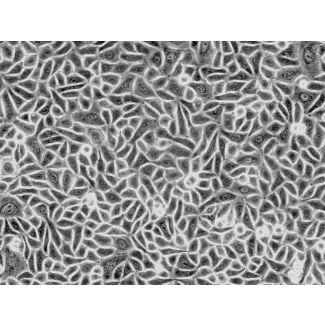Human Hair Follicular Keratinocytes (HHFK) - Phase contrast, 200x.
