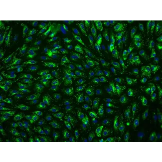 Human Hepatic Sinusoidal Endothelial Cells (HHSEC) - Immunostaining for vWF, 200x
