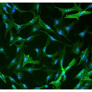 Human Hepatic Stellate Cells (HHSteC) - Immunostaining for α-SMA, 400x.
