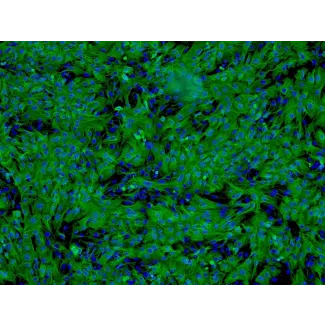 Human Hepatocytes (HH) - Immunostaining for CK-18, 100x.
