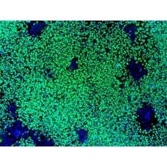 HiPSC-Derived Neural Crest Cells (HiPSC-NCC) - Immunostaining for SOX10, 100x