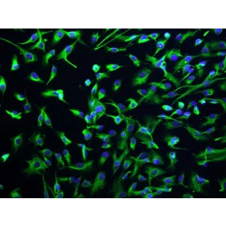 Human Intrahepatic Biliary Epithelial Cells (HIBEpiC)-Immunostaining for CK-18 (Sigma -Aldrich, Cat. #C1399), 200x.
