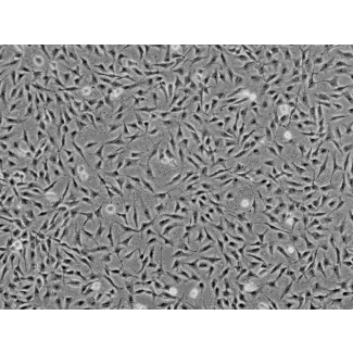 Human Keratocytes (HK) - Phase contrast, 100x.
