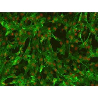 Human Leptomeningeal Pericytes (HLP) – Immunostaining for PDGF Receptor-Beta, 200x

