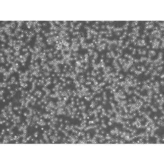 Human Lymphatic Mononuclear Cells (HLyMC) – Phase Contrast, 200x
