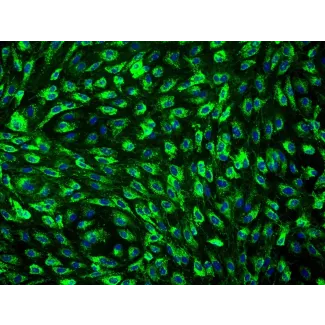 Human Mammary Microvascular Endothelial Cells (HMMEC) - Immunostaining for vWF, 200x.
