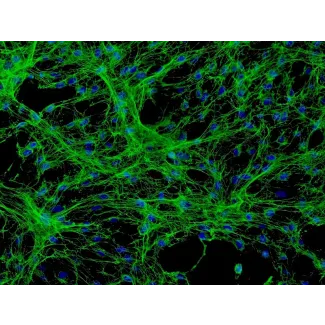 Human Meningeal Cells (HMC) - Immunostaining for Fibronectin, 200x.
