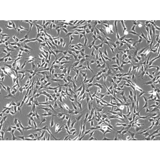 Human Middle Ear Fibroblasts (HMEF)-Phase Contrast, 100x