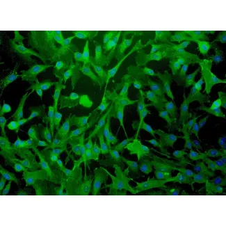 Human Myometrial Smooth Muscle Cells (HMSMC)-Immunostaining for α-sma, 200x.
