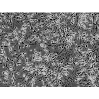 Human Neurons-hippocampal (HN-h) - Phase contrast, 200x.
