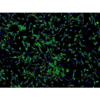 Human Ocular Choroid Fibroblasts (HOCF) - Immunostaining for Fibronectin, 100x.
