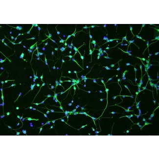 Human Oligodendrocyte Precursor Cells (HOPC) - Immunostaining for A2B5, 100x.
