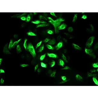 Human Oral Keratinocytes (HOK) - Immunostaining for CK-19, 400x.
