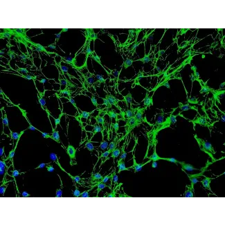 Human Osteoblasts-femoral (HO-f) - Immunostaining for Fibronectin, 200x.
