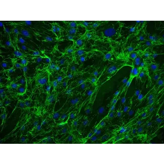 Human Ovarian Fibroblasts (HOF) - Immunostaining for Fibronectin, 200x.
