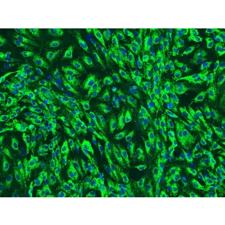 Human Pancreatic Microvascular Endothelial Cells (HPaMEC)-Immunostaining for vWF (Sigma-Aldrich Cat. #F3520), 200x.
