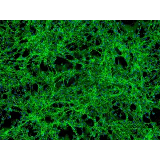 Human Pericardial Fibroblasts (HPcF) - Immunostaining for Fibronectin, 100x.
