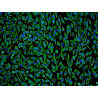 Human Perineurial Cells (HPNC) - Immunostaining for Vimentin, 100x.
