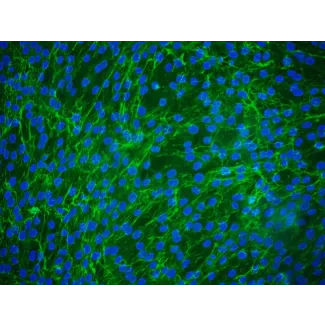 Human Peridontal Ligament Fibroblasts (HPLF) - Immunostaining for Fibronectin, 200x.
