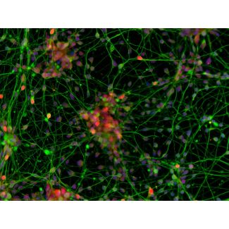 Human Pluripotent Stem Cell derived-Cortical Neurons immunostained for TBR1 (red) and beta tubulin III (green) 200X